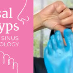 Sinus and Nose Reflexology Points for Nasal Polyps